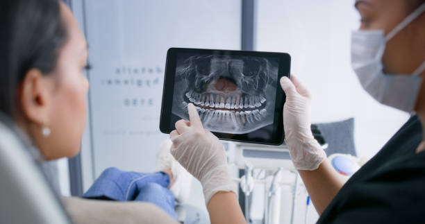 Licensed Dental Implants service in Modesto, CA - Smile Center Dentistry