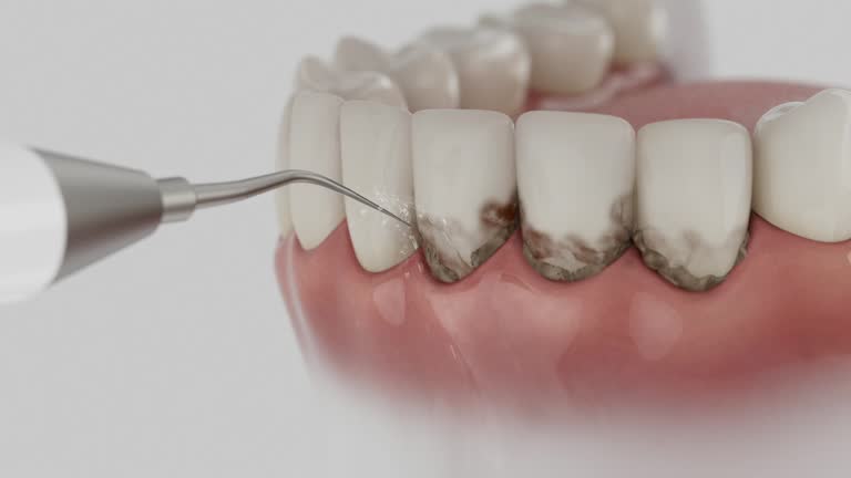 Reliable Dental Implants contractor in Modesto, CA by Smile Center Dentistry